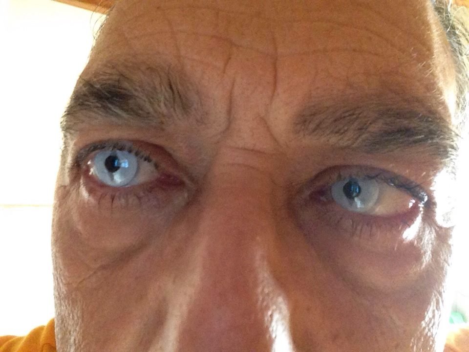 Occhi Con Lenti A Contatto Colorate